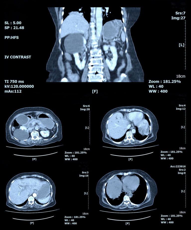 Gastroenterološki pregled u Affidei ‒ scan abdomena 