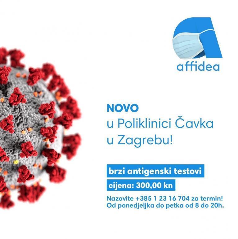 brzi antigenski test COVID-19 / SARS-CoV-2 Affidea Čavka, Zagreb