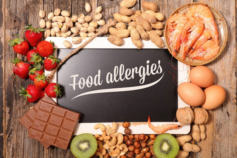sezonske alergije –nutritivni alergeni – jagode - blog - Affidea