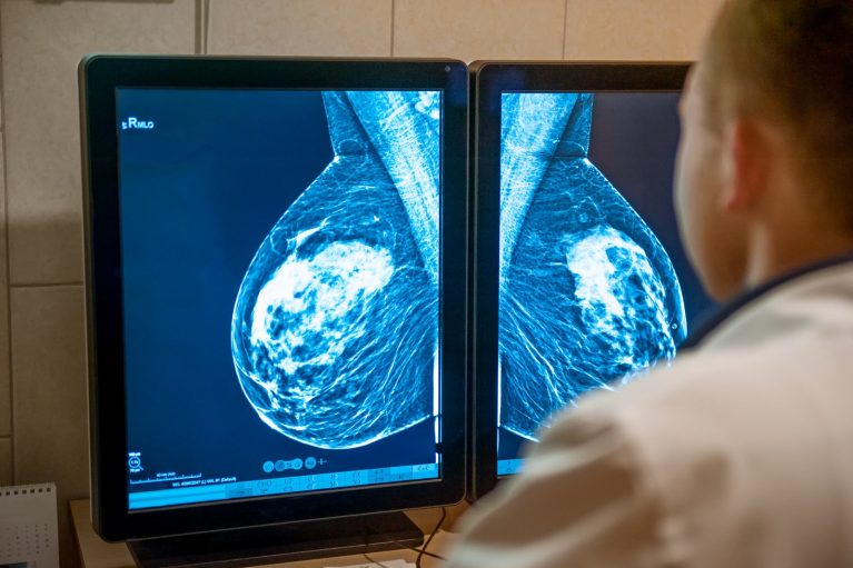 mjesec prevencije raka dojke u Affidei