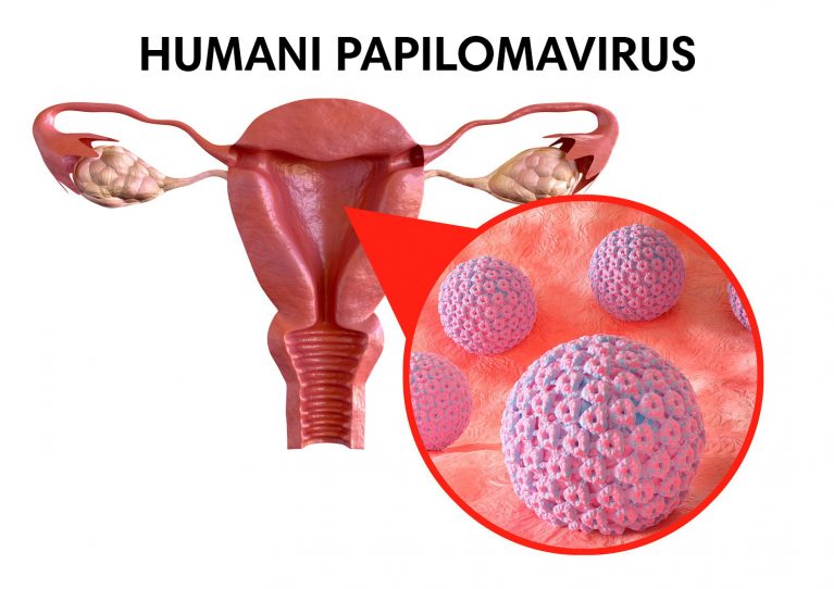 Rak vrata maternice – cjepivo protiv HPV-a 