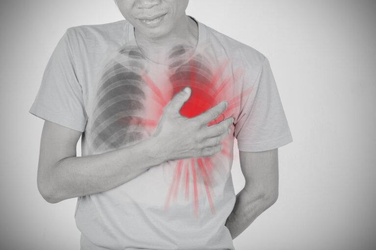 RTG srca i pluća - Affidea