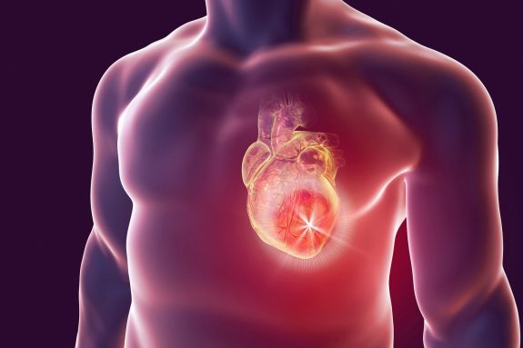 Kardiovaskularne bolesti - kako se dijagnosticiraju i liječe? – Blog Affidea